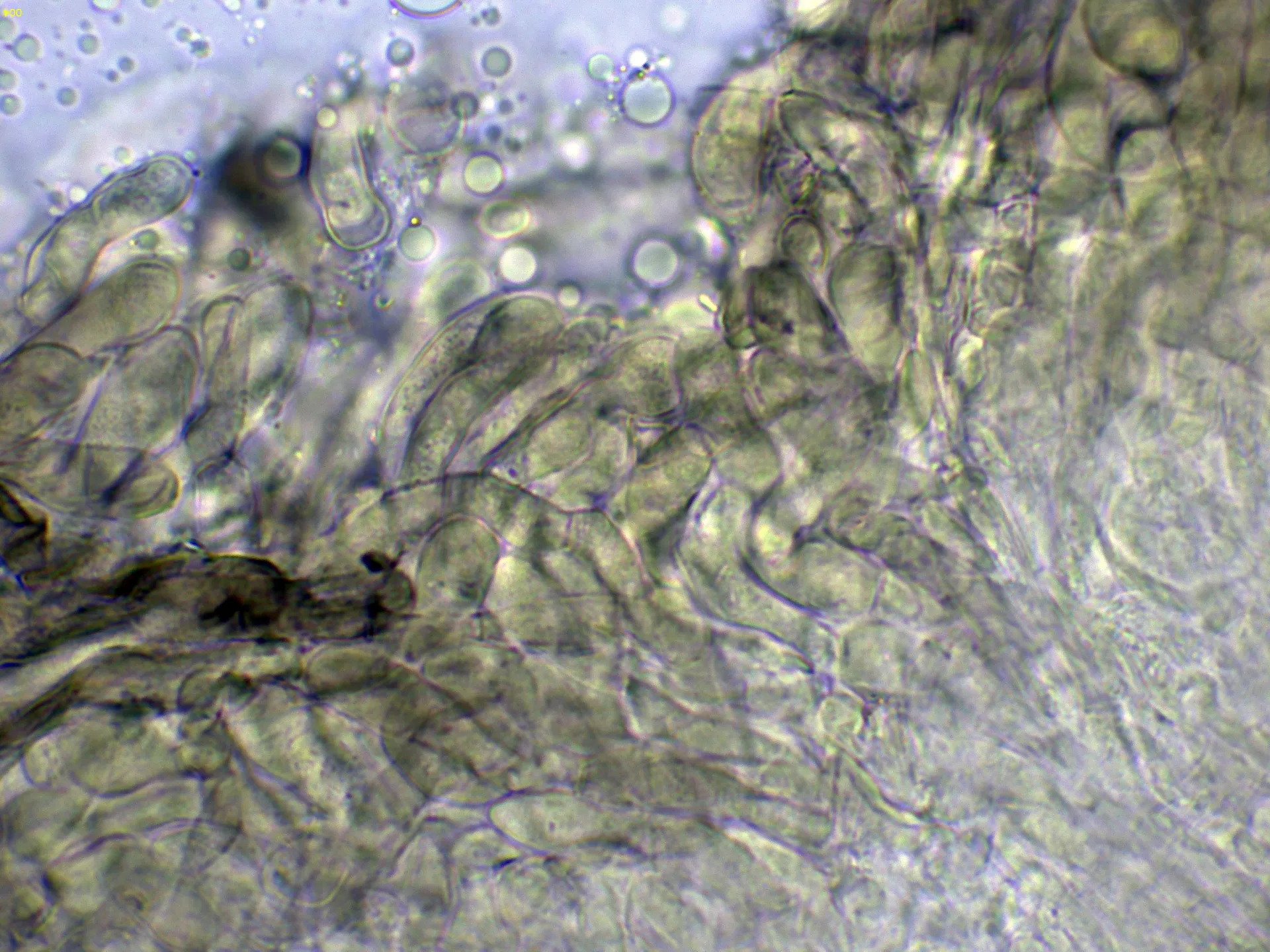 10 - Excípulo Melzer-004